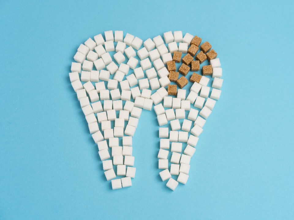 虫歯のイメージ